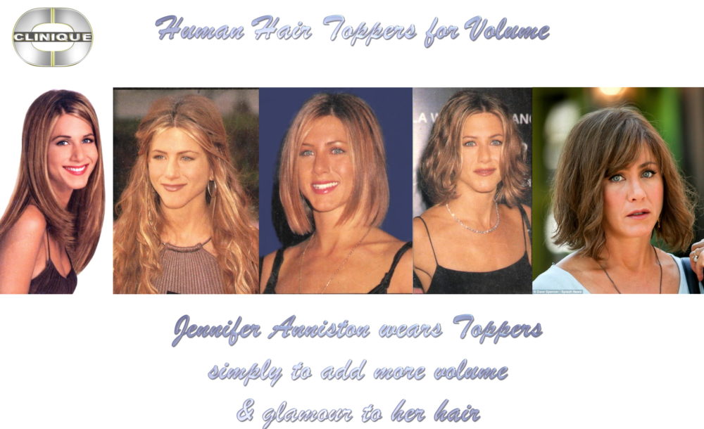 The Hair Clinic Montreal Wigs Toppers Hair Replacement Hair Extensions